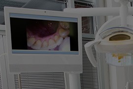 Intraoral photos on chairside computer